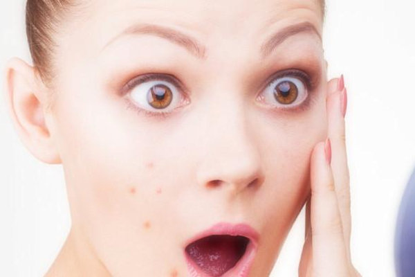 Make-up pour acné:  les maquillages pour le choisir bien!